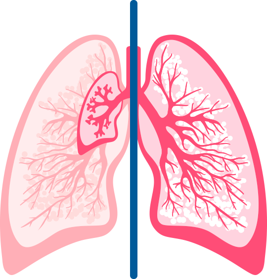 Preterm versus Full Term Lungs